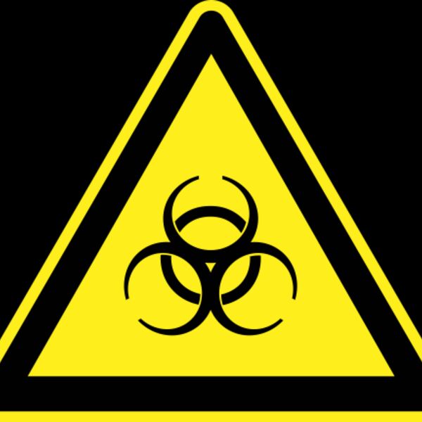 h0us3s Signs Hazard Warning 11 Thumbnail